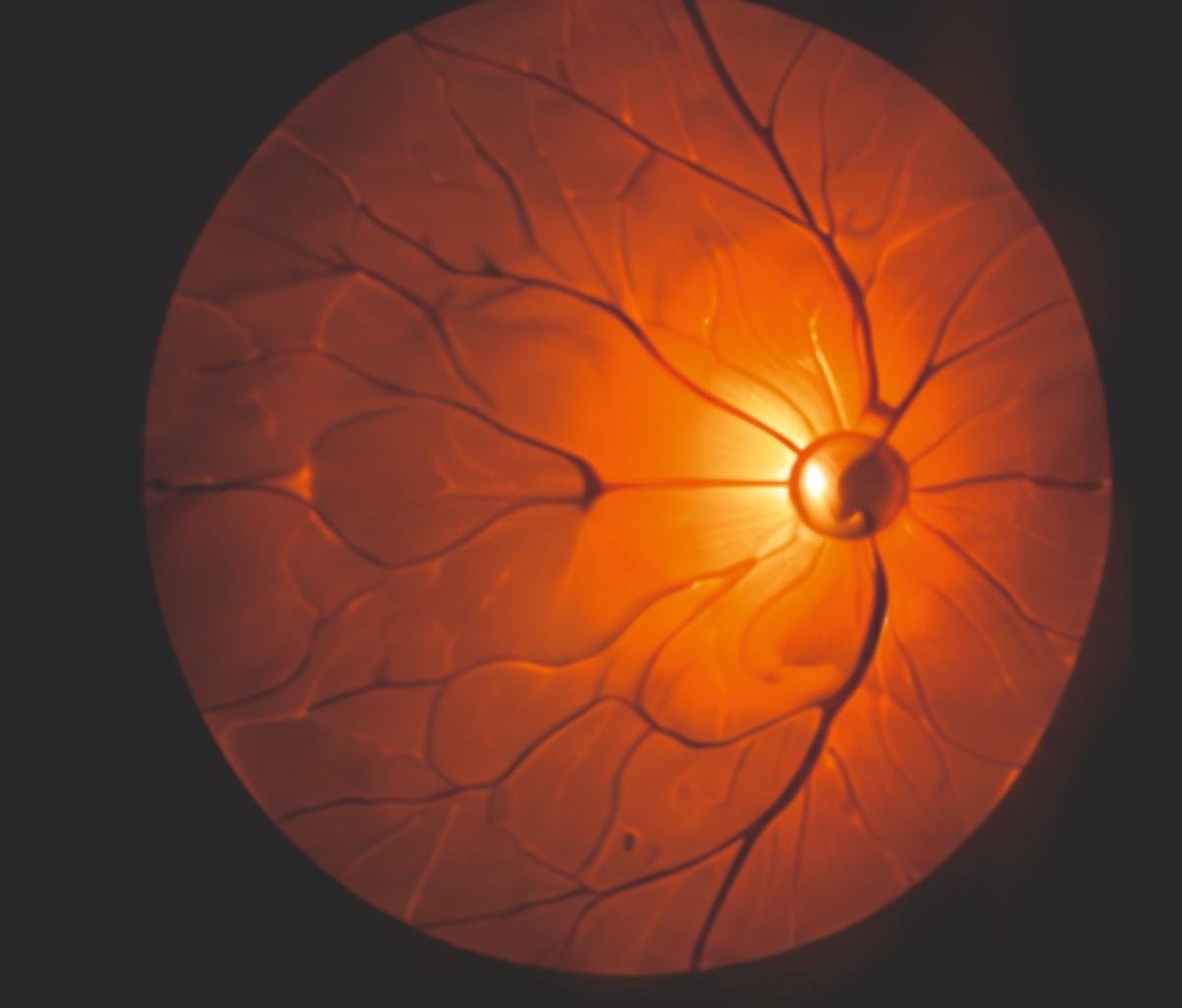 Retina-Treatment